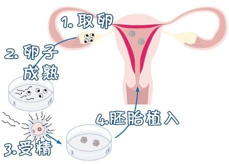 男科